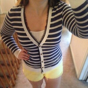 C. Wonder Navy and White Striped Cardigan